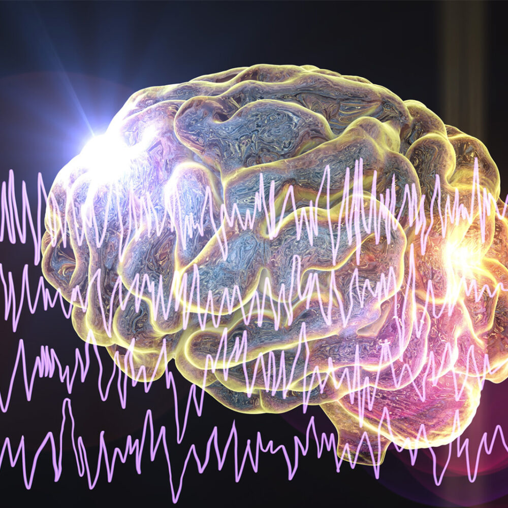 EPILEPSIJA